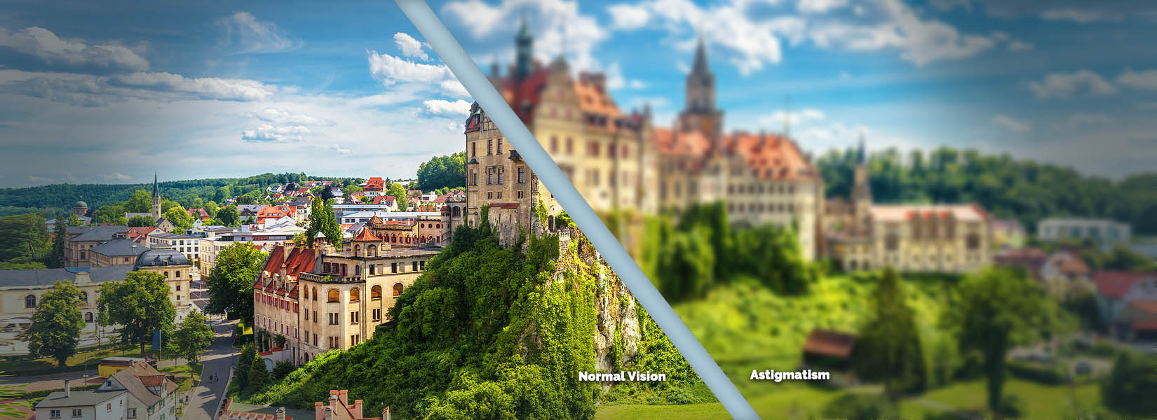 Astigmatism Treatment in North Side