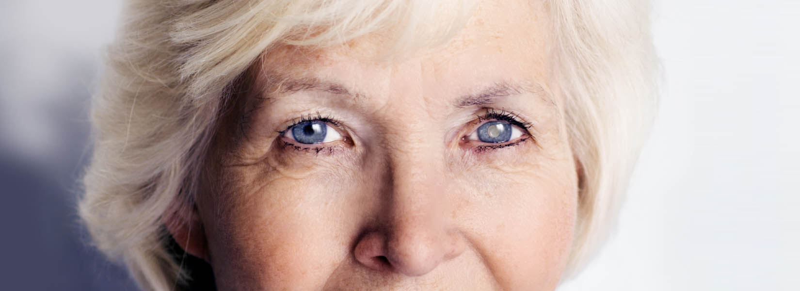 Cataract Surgery in North Side